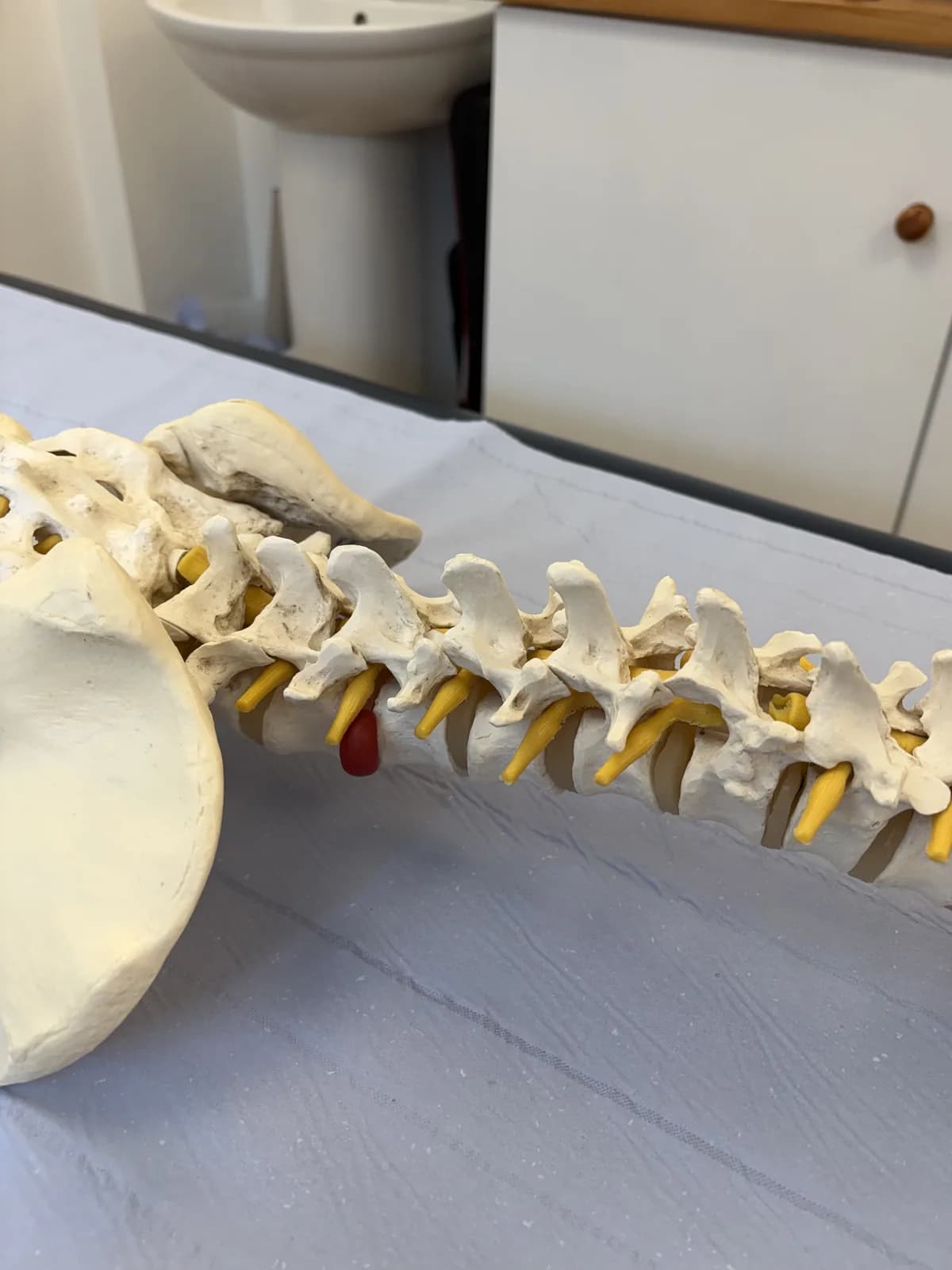 Articulated spine model on the treatment table at Atlas Osteopathy Finchley, used to explain diagnoses.